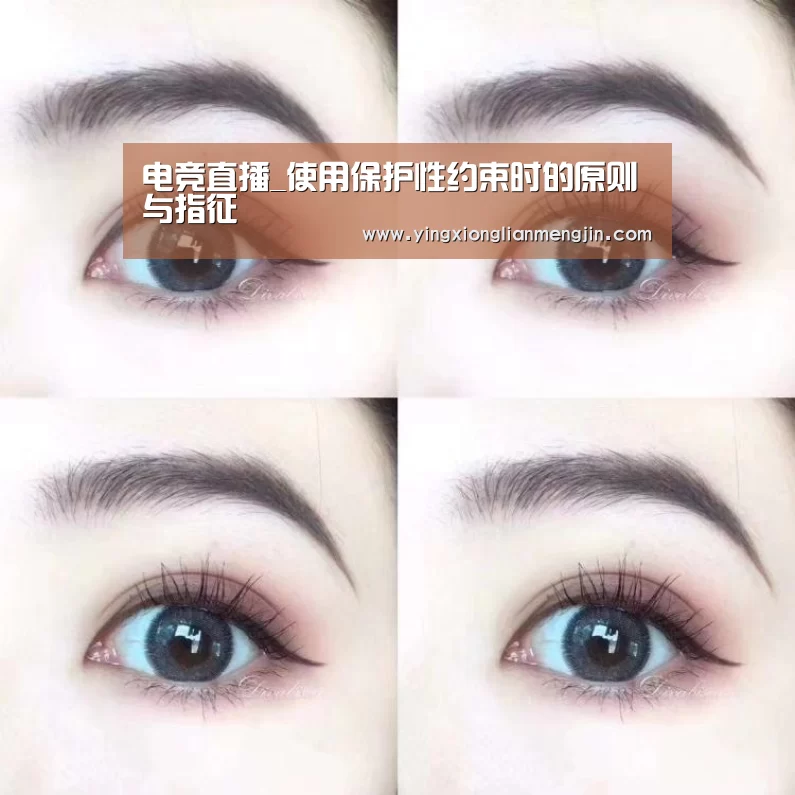 LOL英雄联盟投注 - 官方电竞竞猜平台